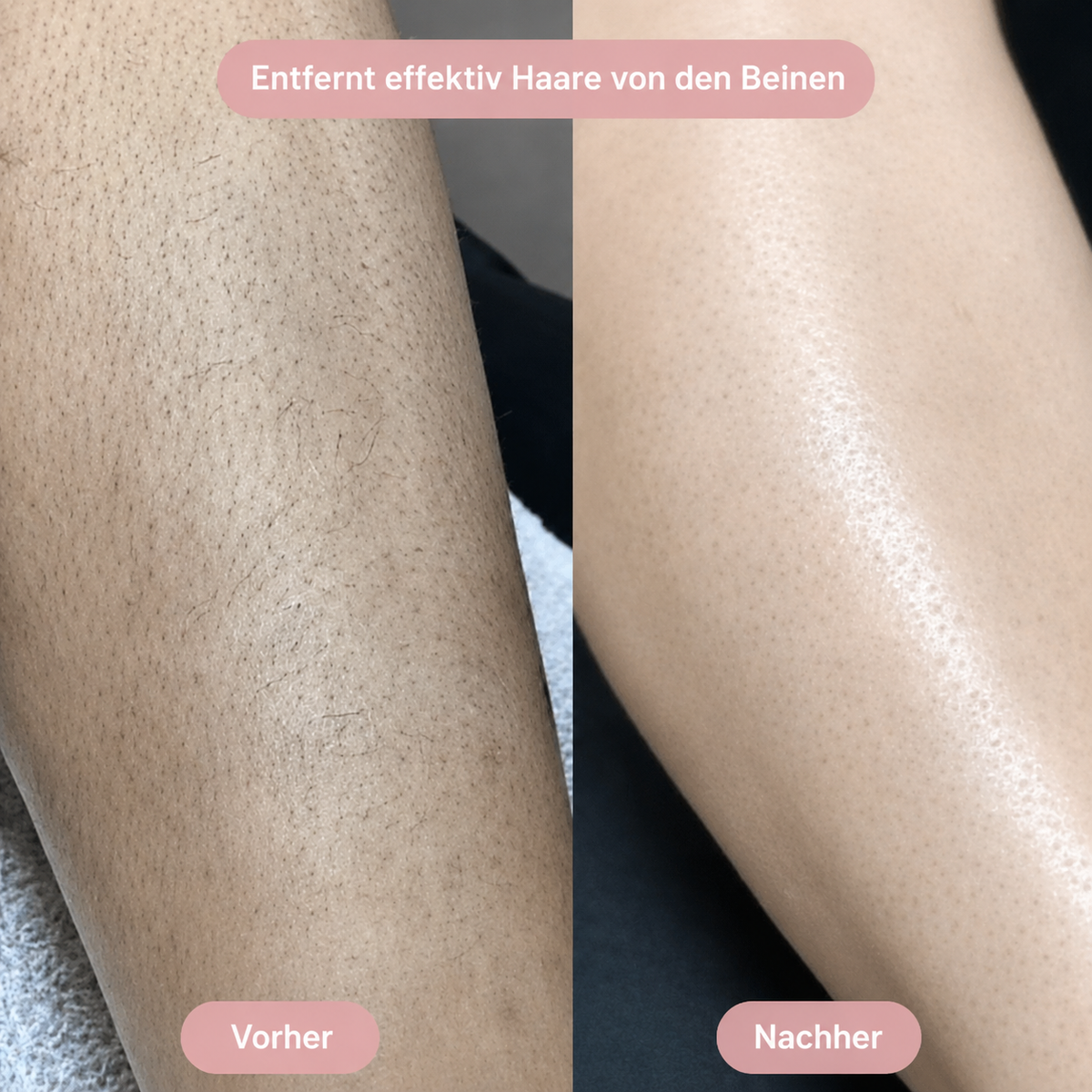 SilkySkin – Intimrasur ohne Hautirritationen